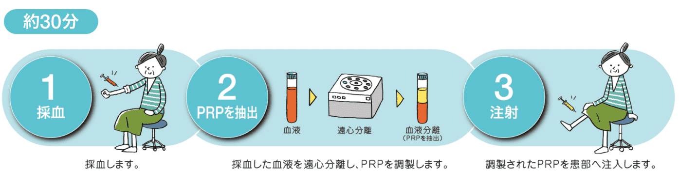 PRP療法のながれ(約30分)
